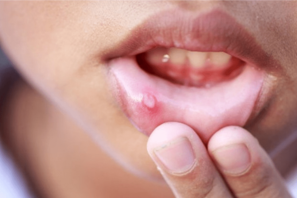 La imagen tiene un atributo ALT vacío; su nombre de archivo es image.png